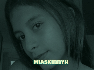 Miaskinnyh