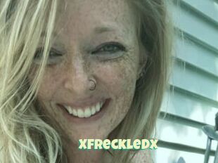 Xfreckledx